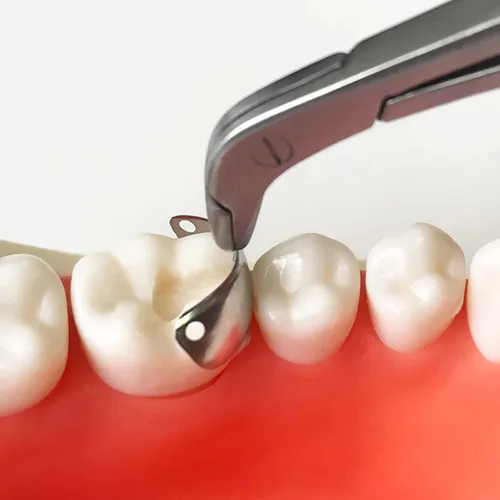 Vista 6 de Anillo de sujeción de resina dental, matrices seccionales dentales, bandas de matriz metálica con salientes de orificio para dentales (F3 negro)