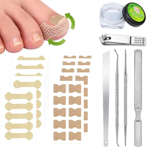 Vista 10 de Juego de corrector de uñas encarnadas con lupa y tiras correctoras, juego de herramientas profesionales de tratamiento de uñas encarnadas, cuidado