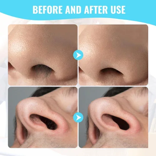 Vista 7 de Cuchillo de nariz de doble cara 2 en 1, herramienta de eliminación de vello de fosa nasal de 360°, cortador de pelo nasal, recortador de vello nasal
