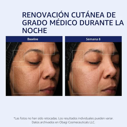 Vista 4 de Obagi Medical Retinol + PHA Refining Night Cream - Clínicamente probada, de doble acción, crema facial antienvejecimiento durante la noche para una