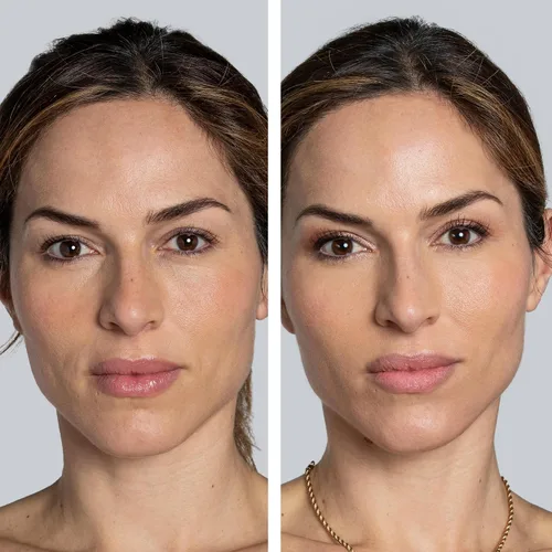 Vista 6 de COCUNAT - The Real C 30 Days - Suero de vitamina C - 20% de ácido ascórbico - Reduce arrugas e imperfecciones - Brillo y elasticidad