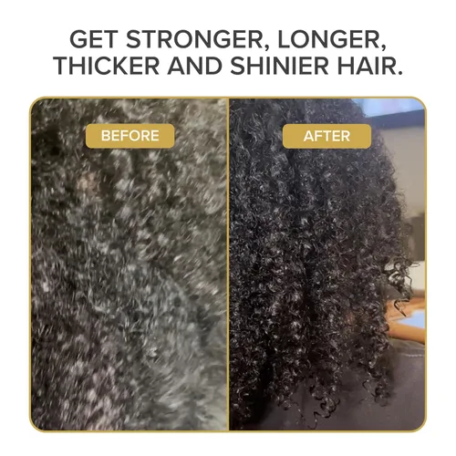 Vista 6 de Shedavi Mascarilla para el cabello - Tratamiento de proteínas con queratina para el cabello seco y dañado