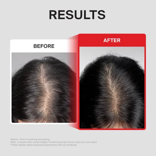 Vista 5 de Dr.FORHAIR Folligen - Suero espesante para el cuero cabelludo, 1.7 onzas, suero de densidad de biotina para cabello más grueso y de aspecto más