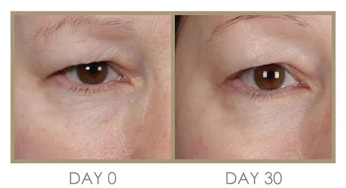 Vista 2 de Genie H 'Eye 'drator Eye Crema