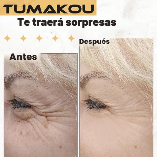 Vista 3 de Reemplazo de tubo de vidrio de seta de alta frecuencia para TUMAKOU Naranja