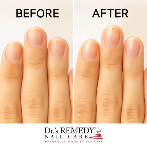 Vista 3 de Dr.'s Remedy Total Dos en Uno Esmalte de uñas base y capa superior de esmalte transparente orgánico de secado rápido, combinación transparente