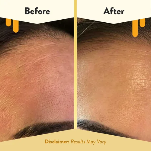 Vista 4 de ECZEMA HONEY Limpiador facial de avena – El lavado facial de eccema natural evita brotes – Limpiador facial suave diario para piel seca