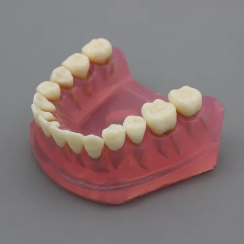 Vista 9 de Modelo de dientes de implante dental con dientes extraíbles para profesionales dentales y estudiantes