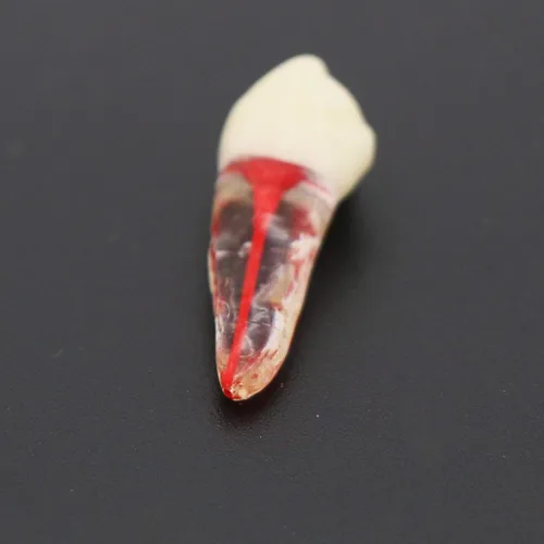 Vista 6 de 8pcs dientes modelo endodoncia endodoncia archivo RCT práctica pulpa para enseñanza estudio