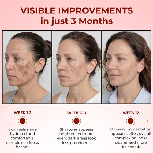 Vista 5 de ABERA Suero de azafrán renovador, tratamiento de melasma de alta potencia para cara y cuerpo, removedor de manchas oscuras para la edad, pecas