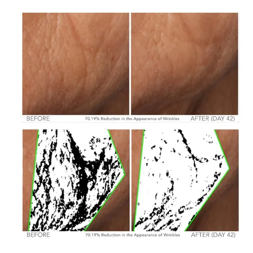 Vista 5 de Serious Skincare - Beyond - Suero intensivo de vitamina C para la cara - Tratamiento facial de 60 días para una piel sana y brillante e iluminadora
