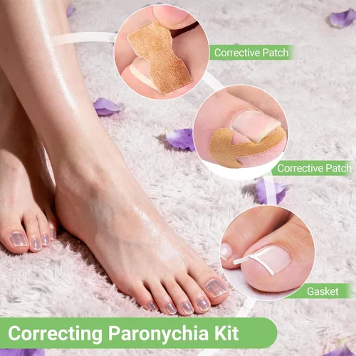 Vista 3 de Juego de corrector de uñas encarnadas con tiras correctoras, kit de herramientas profesionales para uñas de los pies, incluye tiras transpirables