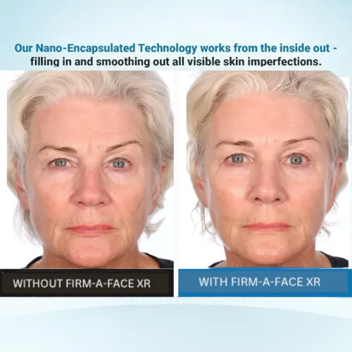 Vista 4 de Serious Skincare - Instant FIRM A FACE XR - Tensor facial temporal - Firme invisiblemente, levanta y suaviza el aspecto de líneas finas, arrugas