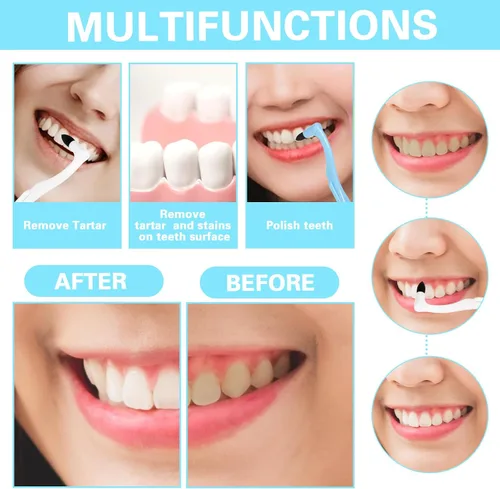 Vista 5 de Gjinxi Borrador de manchas de dientes, eliminadores de manchas dentales, raspador de dientes, rascador de placa dental, borradores de sarro, pulidor