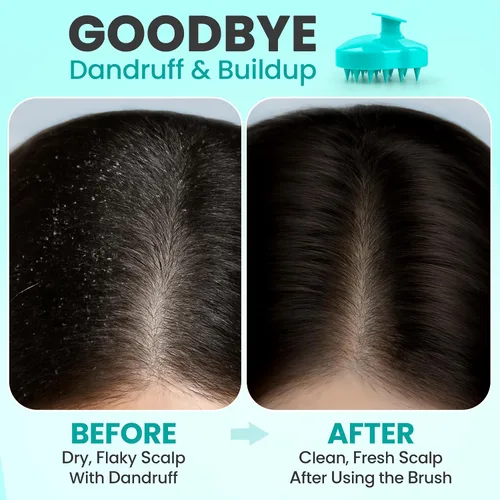 Vista 3 de RELAXXO Masajeador de cuero cabelludo para el crecimiento del cabello – Exfoliante y fregador de cabello para cuero cabelludo, cerdas suaves