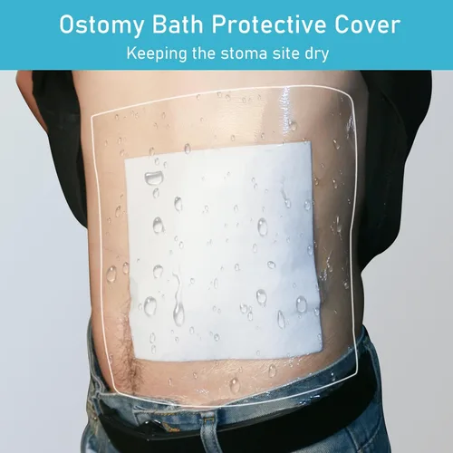 Vista 2 de 25 piezas de bolsa de ostomía impermeable cubierta de ducha de 10 x 10 pulgadas, protector de baño de estoma protector de película adhesiva vendaje