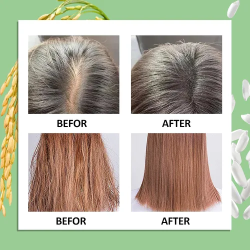 Vista 8 de Agua de arroz WOZUTUNT para el crecimiento del cabello, 7.14 onzas líquidas sin enjuague, productos para el cuidado de mujeres y hombres, aerosol