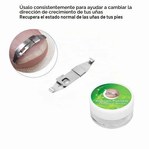 Vista 3 de Corrección de uñas encarnadas plateadas de 17 a 0.866 in ajustable de acero inoxidable corrector de uñas de pedicura paroniquia herramienta