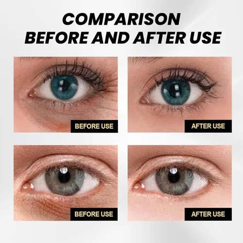 Vista 6 de Crema tensora temporal de ojos fórmula avanzada de elevación instantánea con L-carnosina para ojeras e hinchazón