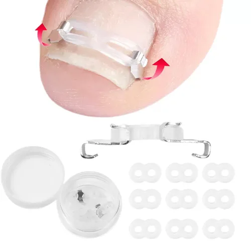 Vista 7 de Kit corrector de uñas encarnadas para hombres y mujeres, herramienta de uñas encarnadas, 2 clips de acero inoxidable, tiras de uñas curvas