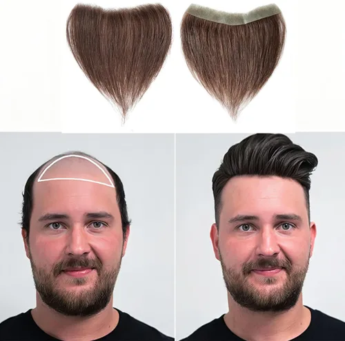 Vista 28 de Extensión frontal de cabello rubio claro para hombres, extensión de cabello lacio con pérdida de línea de cabello humano con cinta adhesiva