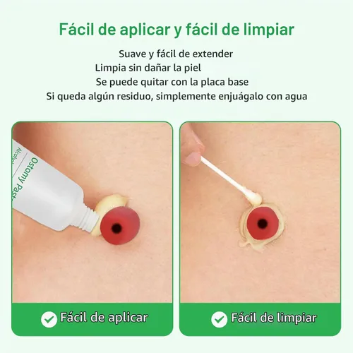 Vista 3 de Stoma Skin Barrer Paste, pasta de ostomía tubo de 2 onzas