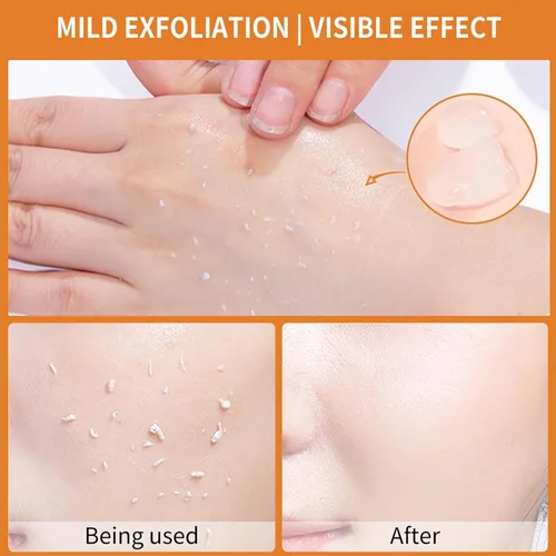Vista 5 de 3 unidades de gel exfoliante naranja, limpieza profunda, piel hidratante, eliminación de puntos negros, piel suave y poros de limpieza profunda, gel
