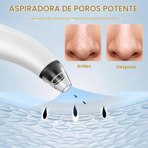 Vista 7 de Blackhead Remover Tools,Electric Vacuum Facial Pore Cleaner Tool(White)