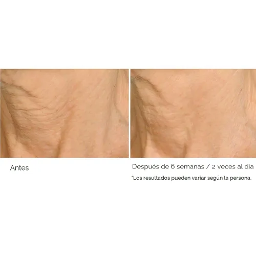 Vista 7 de NassifMD Deco-Lift Neck & Decollete Firming & Lifting Complex