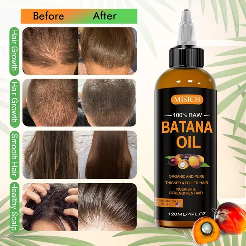 Vista 4 de MISICH Dr Sebi - Aceite de batana crudo, 100% natural y orgánico para el crecimiento del cabello, para hombres y mujeres, procedente de Honduras