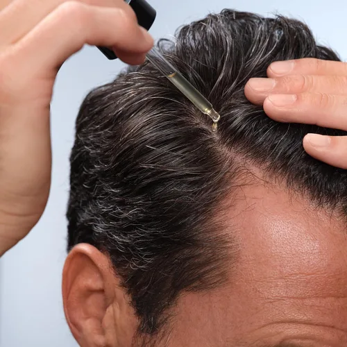 Vista 5 de Caldera + Lab The Hair Serum Suero espesante para hombres para adelgazar y retroceder el cabello, soporta un cabello más completo y de aspecto más
