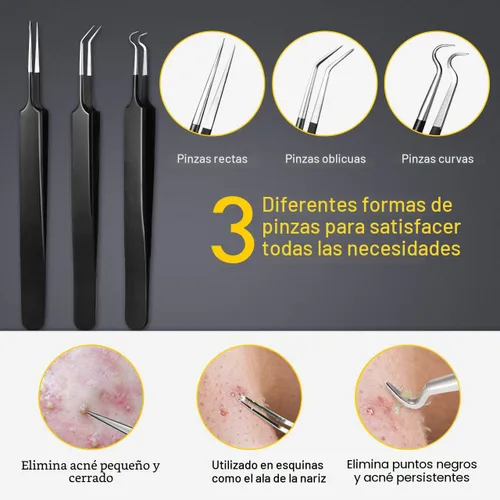 Vista 4 de Boxoyx - Kit de herramientas para reventar espinillas, kit de 10 piezas para eliminar puntos negros, kit extractor de comedones con caja