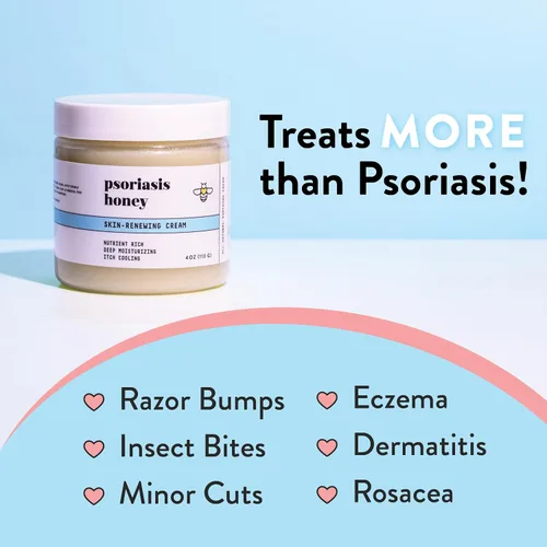 Vista 5 de PSORIASIS HONEY Crema renovadora de la piel, crema para eccema y dermatitis seborreica, tratamiento de psoriasis para aliviar la piel