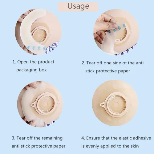 Vista 6 de 20PCS Ostomía Suministros Ostomía Barrera Tiras de Barrera Elástico para Bolsas de Colostomía