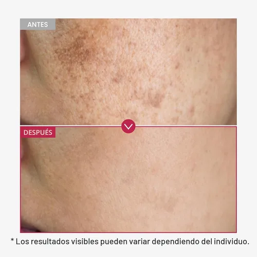 Vista 3 de TOSOWOONG Suero de Niacinamida 10% + Ácido Tranexámico 4%, Arbutina 2%, Ácido Hialurónico, Suero Facial TXA, Piel de Vidrio, Clarificante, Complejo