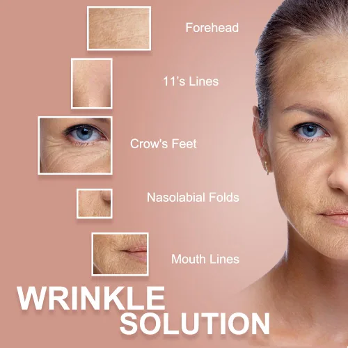 Vista 2 de Akissos Cinta de elevación miofascial facial Cinta de elevación facial Cintas tonificantes faciales Parches antiarrugas Adhesivos anticongelación