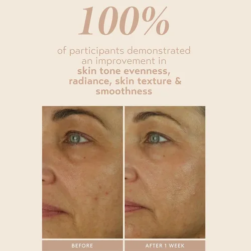 Vista 5 de SHANI DARDEN SKIN CARE Retinol Reform con suero de retinol encapsulado al 1% para cara y cuello, suave suero facial de retinol de liberación lenta