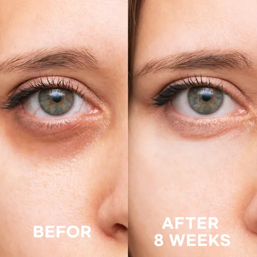 Vista 6 de Epielle Crema reafirmante para ojos Suero antienvejecimiento para la flacidez de la piel y las arrugas Aplicador refrescante para aplicaciones