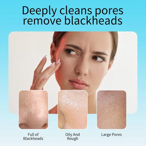 Vista 3 de RtopR Máscara removedor de puntos negros para cara, máscara facial de puntos negros, removedor de puntos negros, tira de poros de nariz para todo