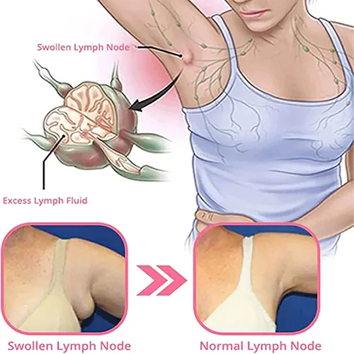 Vista 6 de Lymphvity MagneTherapy - Aretes de germanio, 2 pares de aretes de magnetoterapia linfática para mujer