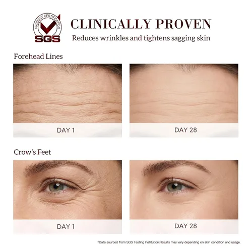 Vista 3 de HKH Suero Bakuchiol Retinol para la cara: 30 cápsulas de suero antienvejecimiento para pieles sensibles - SGS probado para reducir las arrugas en un