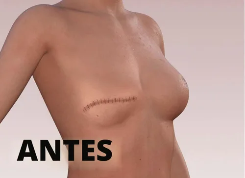 Vista 3 de TuckTats Tatuaje temporal de rosa para cicatrices – Tatuaje realista impermeable de cubierta de cicatrices para mastectomía, reconstrucción