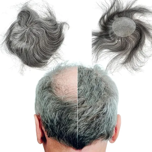 Vista 9 de Voloria Parche para el cabello calvo para hombres, 3.15 x 3.15 pulgadas, sistema de reemplazo de cobertura completa de piel de poliuretano