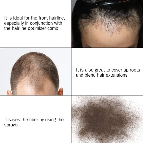 Vista 2 de Aplicador de fibra capilar, boquilla pulverizadora de fibra capilar, herramientas para engrosar el cabello, hombres y mujeres para boquilla