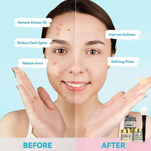 Vista 4 de BOJICA 3 mascarillas faciales de arcilla para el cuidado de la piel, mascarilla facial para limpieza profunda de poros, cúrcuma, mar muerto, barro