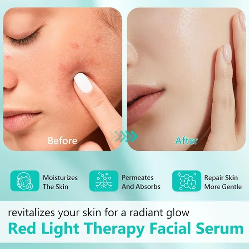 Vista 2 de Suero de activación de terapia de luz roja, sueros de terapia de luz roja para cara y cuello, suero hidratante para cara, sueros faciales