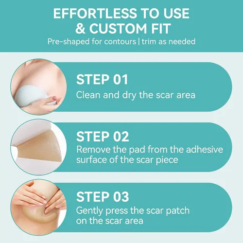 Vista 7 de Láminas de silicona para cicatrices de mama - 6 parches con forma de ancla Medical Grade Silicone, Hypoallergenic & Reusable for Breast Lift