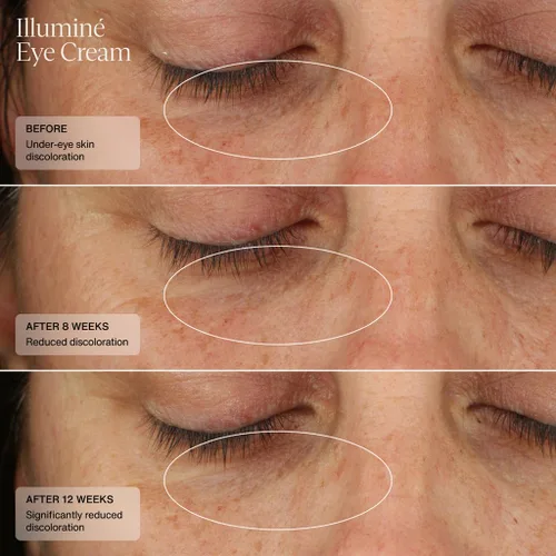 Vista 6 de Senté Illuminé - Crema de ojos para disminuir las ojeras, la decoloración, el enrojecimiento y la hinchazón alrededor de los ojos, con HSA
