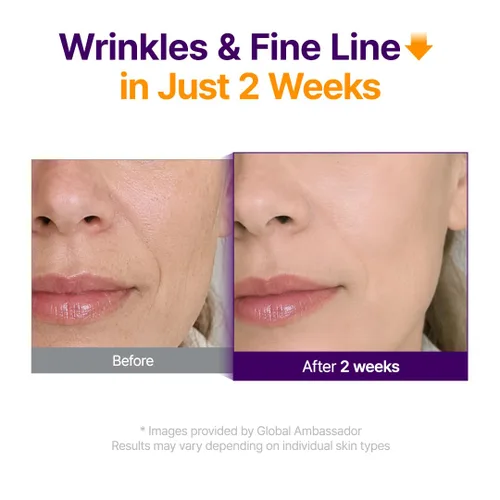 Vista 4 de PURITO Retinol 0.1% + Retinal 0.1% Suero facial antienvejecimiento para arrugas, líneas finas y piel más firme Retinoides duales con NAD+