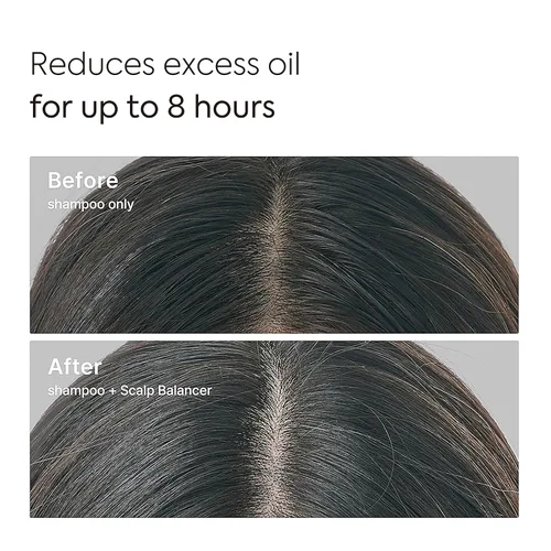 Vista 4 de Apple Zinc Scalp Balancer - Suero de raíz, control del cuero cabelludo graso y con picazón con 1% de zinc PCA y manzana prosesionada en frío, suero